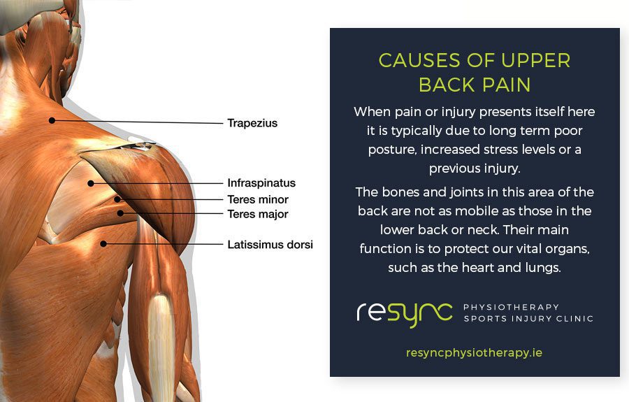 Causes of Upper Back Pain - Physiotherapy Services ReSync - Dublin