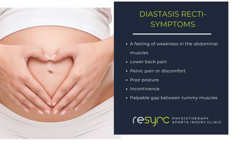 Diastasis Recti Symptoms