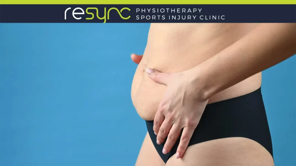 Diastasis recti blog banner 1536x864 1