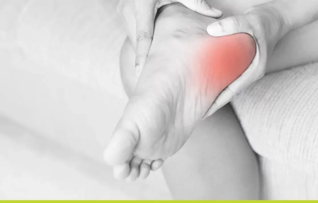 Plantar Fasciitis Treatments Heal Your Heels ReSync Physiotherapy