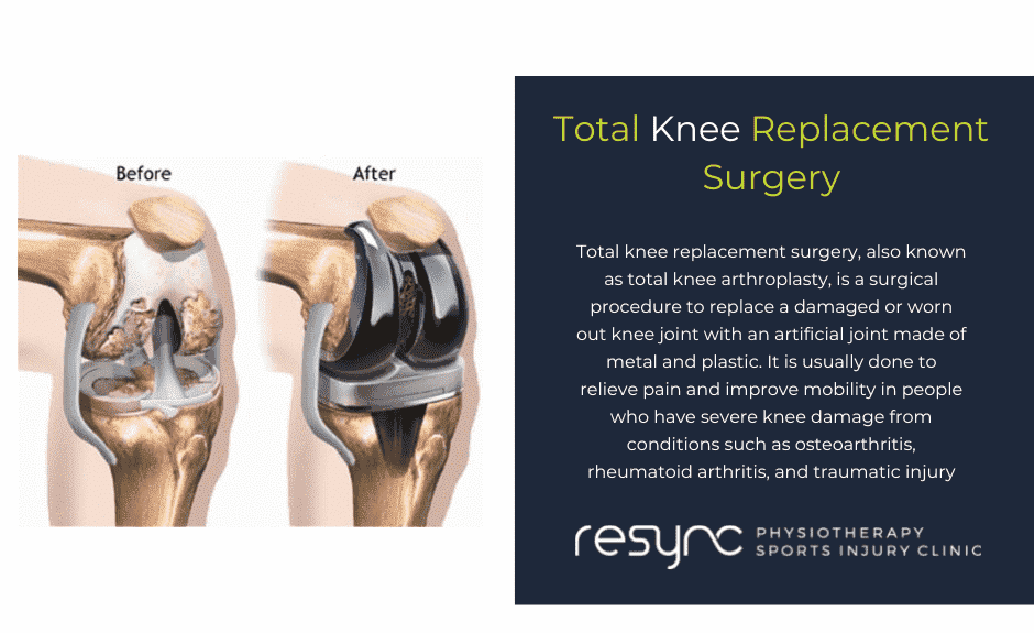 Total KNee Replacment Explained 1